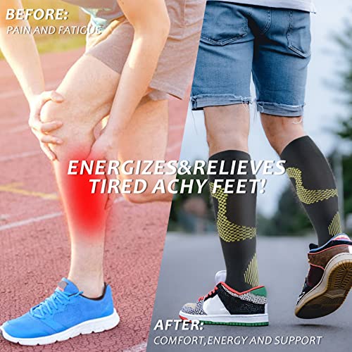 Compression Socks